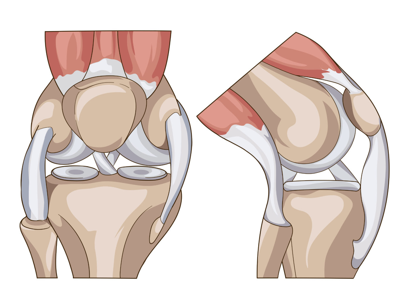 Ligamento cruzado posterior: as principais técnicas cirúrgicas para uma lesão desafiadora